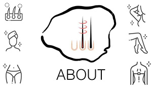 About
